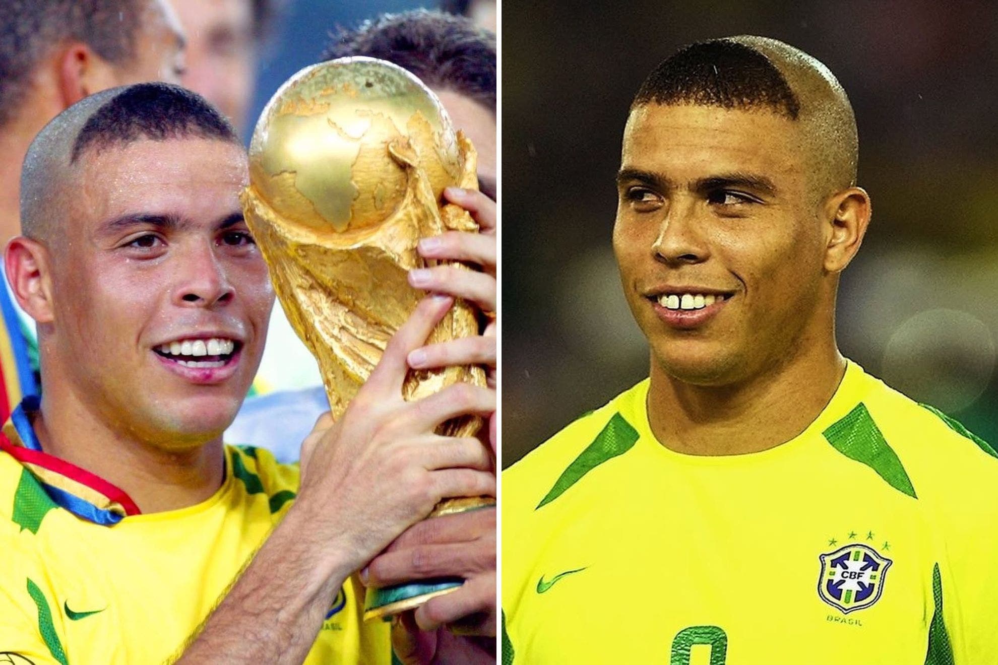 Diện mạo kỳ quặc giúp Ronaldo giải tỏa áp lực chấn thương.